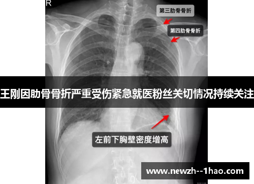 王刚因肋骨骨折严重受伤紧急就医粉丝关切情况持续关注